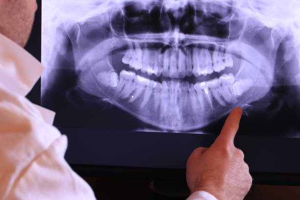 Best Pediatric Emergency Dentist in Syosset, NY